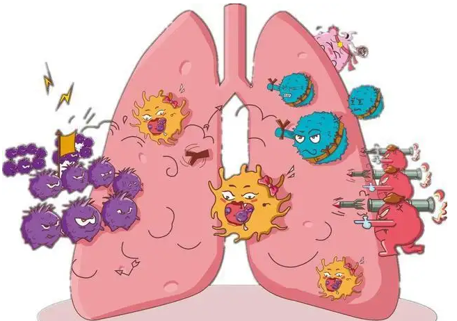 杭州御和堂老中医提醒：肺癌与饮食的关系