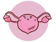 子宫内膜癌的预防措施有哪些呢？杭州老中医告诉你！