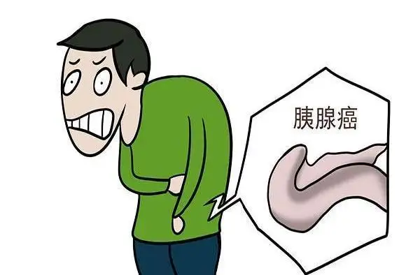 杭州御和堂老中医讲解：胰腺癌的症状有哪些?