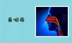 鼻咽癌的早期症状有哪些吗